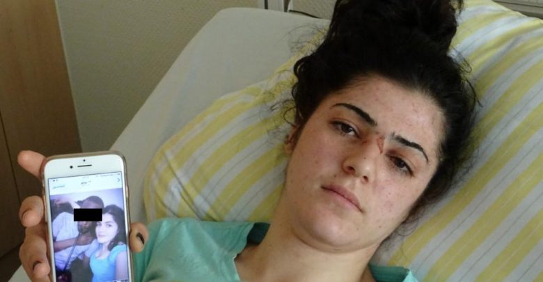 بسبب الغيرة.. شابّة سوريّة تنجو من القتل على يد زوجها في ألمانيا