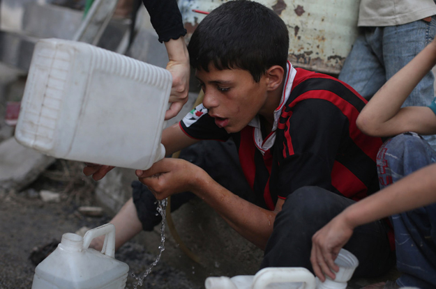 سوء التغذية يصيب الأطفال في البلدات و القرى المحيطة بمعرة النعمان.